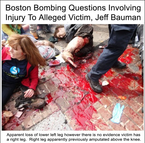 boston-bombing-questions-involving-victim-jeff-bauman-vertical1